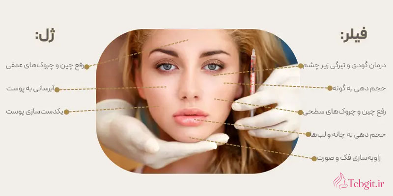 مقایسه کامل فیلر، بوتاکس و مزوژل؛ کدام روش برای چه کسی مناسب است؟